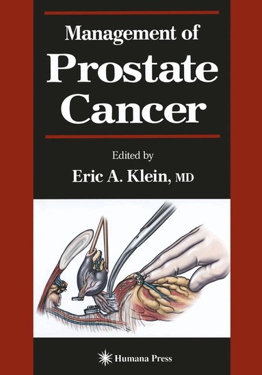 Eric A. Klein - Management of Prostate Cancer, Häftad