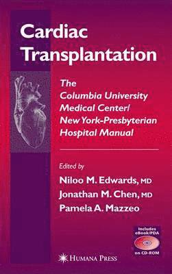 Niloo M. Edwards, Jonathan M. Chen, Pamela A. Mazzeo - Cardiac Transplantation, Häftad