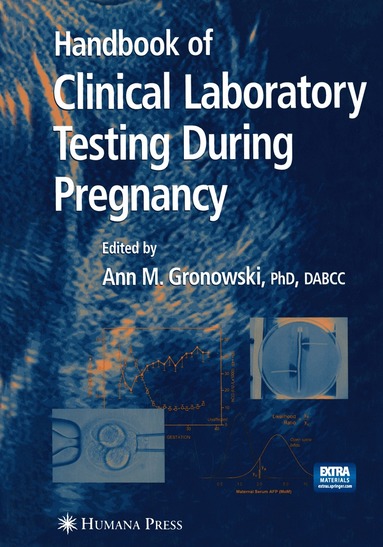 Ann M. Gronowski - Handbook of Clinical Laboratory Testing During Pregnancy, Häftad