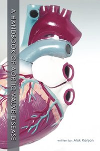 bokomslag A Handbook of Aortic Valve Disease