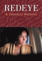 Redeye