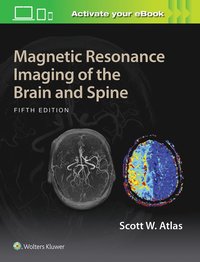 bokomslag Magnetic Resonance Imaging of the Brain and Spine