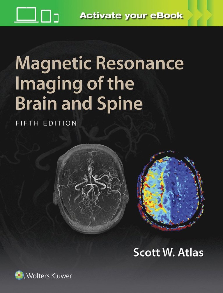 Magnetic Resonance Imaging of the Brain and Spine