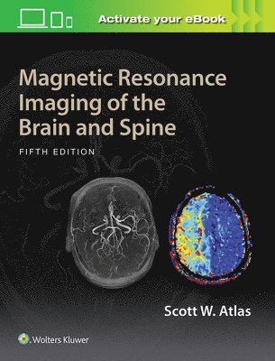 Magnetic Resonance Imaging of the Brain and Spine 1