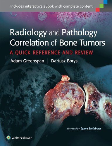 bokomslag Radiology and Pathology Correlation of Bone Tumors