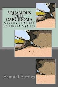 bokomslag Squamous Cell Carcinoma: Causes, Tests and Treatment Options