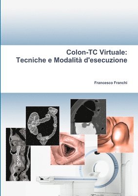 bokomslag Colon-TC Virtuale: Tecniche E Modalita D'esecuzione