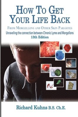 bokomslag How to Get Your Life Back From Morgellons and Other Skin Parasites Limited Edit