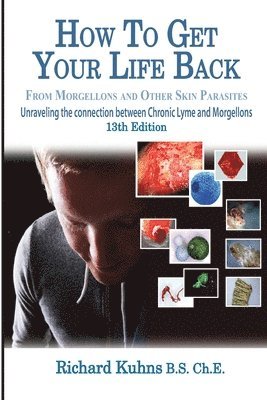 Richard L Kuhns - How to Get Your Life Back From Morgellons and Other Skin Parasites Limited Edit, Häftad