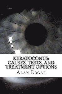 bokomslag Keratoconus: Causes, Tests, and Treatment Options