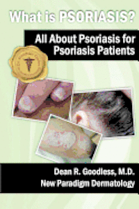 bokomslag What is Psoriasis?: All About Psoriasis for Psoriasis Patients