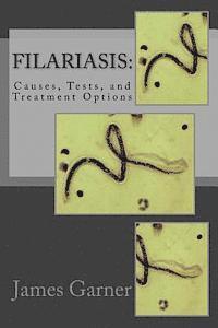 bokomslag Filariasis: Causes, Tests, and Treatment Options