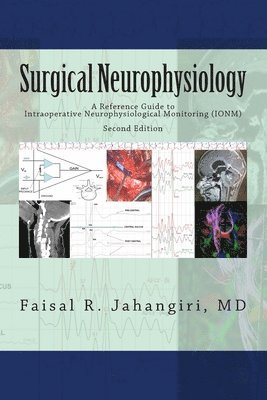 Surgical Neurophysiology - 2nd Edition: A Reference Guide to Intraoperative Neurophysiological Monitoring 1