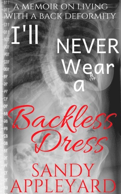 I'll Never Wear a Backless Dress: A memoir on living with a deformity 1