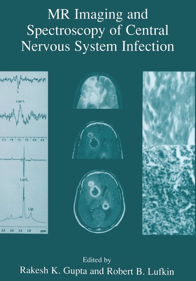 bokomslag MR Imaging and Spectroscopy of Central Nervous System Infection