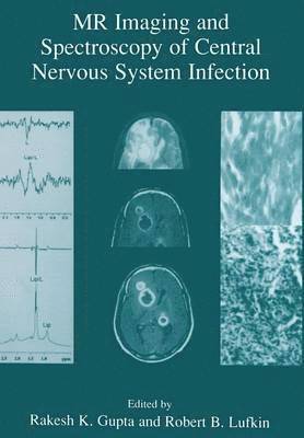 MR Imaging and Spectroscopy of Central Nervous System Infection 1