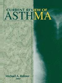 bokomslag Current Review of Asthma