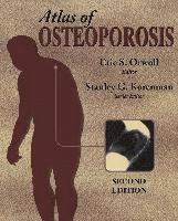 bokomslag Atlas Of Osteoporosis