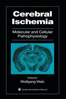 Cerebral Ischemia 1