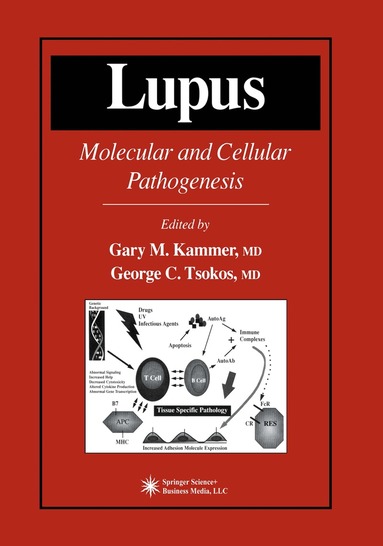 Gary M. Kammer - Lupus, Häftad