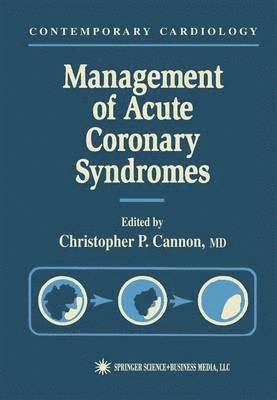 bokomslag Management of Acute Coronary Syndromes