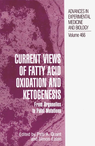 bokomslag Current Views of Fatty Acid Oxidation and Ketogenesis