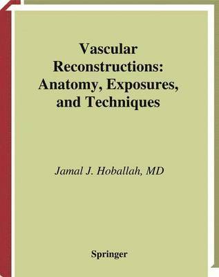 Jamal J. Hoballah - Vascular Reconstructions, Häftad