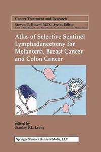 bokomslag Atlas of Selective Sentinel Lymphadenectomy for Melanoma, Breast Cancer and Colon Cancer