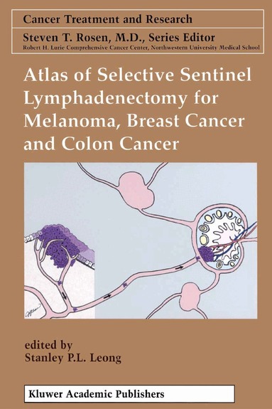 Stanley P. L. Leong - Atlas of Selective Sentinel Lymphadenectomy for Melanoma, Breast Cancer and Colon Cancer, Häftad