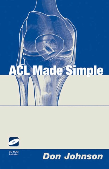 Don Johnson - ACL Made Simple, Häftad