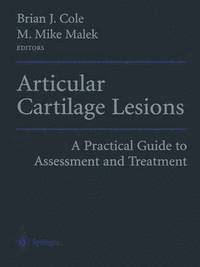 bokomslag Articular Cartilage Lesions