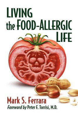 Mark S. Ferrara - Living the Food-Allergic Life, Häftad