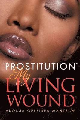 bokomslag ''Prostitution'' My Living Wound