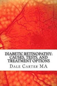 bokomslag Diabetic Retinopathy: Causes, Tests, and Treatment Options