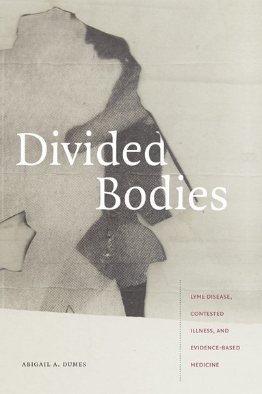 Abigail A. Dumes - Divided Bodies, Inbunden