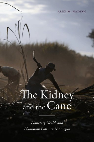 Alex M. Nading - Kidney and the Cane, Häftad