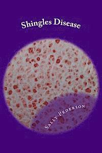 bokomslag Shingles Disease: The Complete Guide