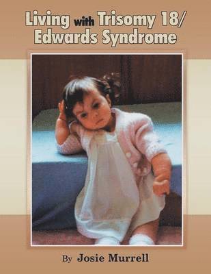 Living with Trisomy 18 / Edwards Syndrome 1