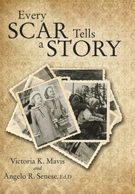 Every Scar Tells a Story 1