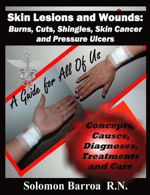 Skin Lesions and Wounds: Burns, Cuts, Shingles, Skin Cancer and Pressure Ulcer: ( Concepts, Causes, Diagnoses, Treatment and Care ) 1