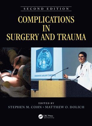 Complications in Surgery and Trauma