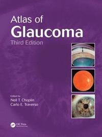 bokomslag Atlas of Glaucoma