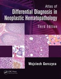 bokomslag Atlas of Differential Diagnosis in Neoplastic Hematopathology