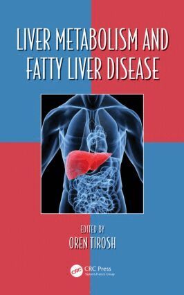 Oren Tirosh - Liver Metabolism and Fatty Liver Disease, Inbunden