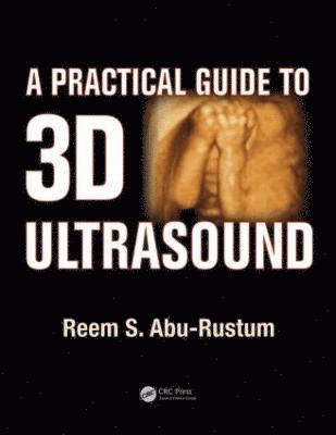 bokomslag A Practical Guide to 3D Ultrasound