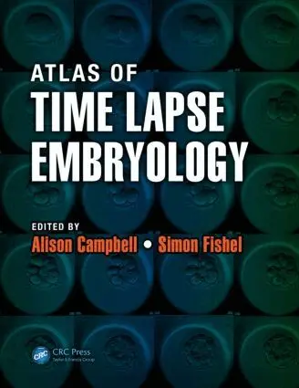 Alison Campbell, Simon Fishel - Atlas of Time Lapse Embryology, Häftad. Tillgänglighet: Lägg i varukorg