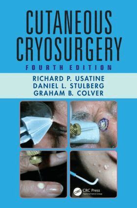 Richard P. Usatine, Daniel L. Stulberg, Graham B. Colver - Cutaneous Cryosurgery, Inbunden