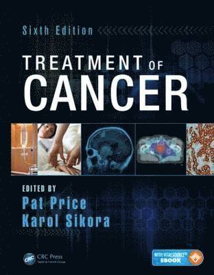 Treatment of Cancer 1