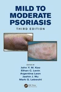 bokomslag Mild to Moderate Psoriasis