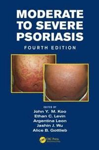 bokomslag Moderate to Severe Psoriasis